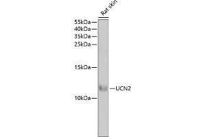 Urocortin 2 antibody  (AA 20-112)