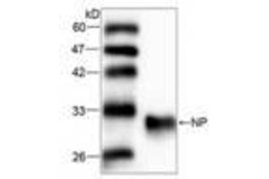 Image no. 1 for anti-Nucleoside Phosphorylase (NP) (AA 68-289) antibody (ABIN791487)