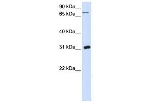 Image no. 1 for anti-Uridine Phosphorylase 1 (UPP1) (N-Term) antibody (ABIN631743)