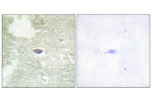 Image no. 2 for anti-Transforming Growth Factor, beta Receptor II (70/80kDa) (TGFBR2) (pSer225), (pSer250) antibody (ABIN1847404)