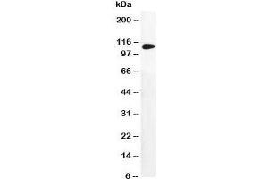Image no. 2 for anti-Dihydropyrimidine Dehydrogenase (DPYD) (AA 33-52) antibody (ABIN3030731)