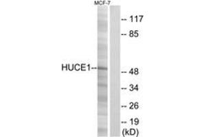 Image no. 1 for anti-Ribosomal RNA Processing 8 (RRP8) (AA 271-320) antibody (ABIN2890209)