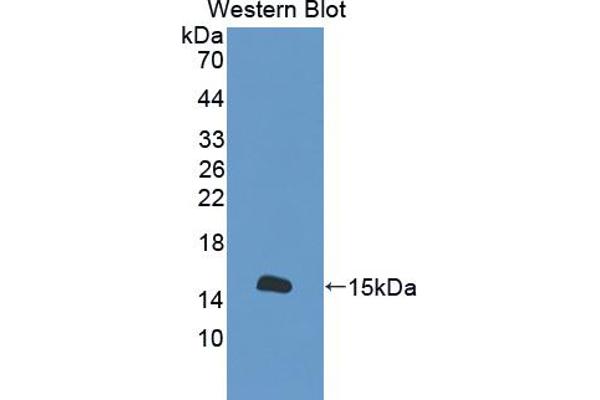 anti-S100 Calcium Binding Protein A16 (S100A16) (AA 1-97) antibody