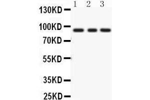 Image no. 2 for anti-Protein Kinase C, epsilon (PRKCE) (AA 53-236) antibody (ABIN3043908)