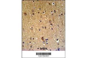 Image no. 2 for anti-Zinc Finger, DHHC-Type Containing 9 (ZDHHC9) (AA 335-364), (C-Term) antibody (ABIN653671)