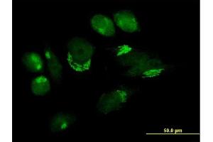 Immunofluorescence of purified MaxPab antibody to B4GALT4 on HeLa cell.