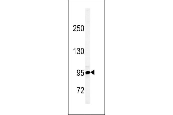 JHDM1D Antikörper  (AA 290-316)