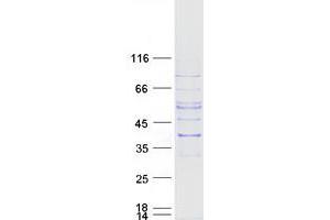 Image no. 1 for Solute Carrier Family 25 (Mitochondrial Carrier, Graves Disease Autoantigen), Member 16 (SLC25A16) protein (Myc-DYKDDDDK Tag) (ABIN2732157)