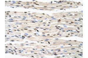 Image no. 1 for anti-Heterogeneous Nuclear Ribonucleoprotein D-Like (HNRPDL) (Middle Region) antibody (ABIN629895)