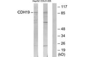 Image no. 1 for anti-Cadherin 19 (CDH19) (AA 371-420) antibody (ABIN1534288)