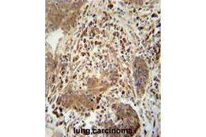 Image no. 2 for anti-T-Cell Activation rho GTPase-Activating Protein (TAGAP) (AA 103-129), (Middle Region) antibody (ABIN955071)