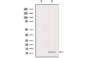 Western blot analysis of extracts from Rat spleen, using RPL37 Antibody.