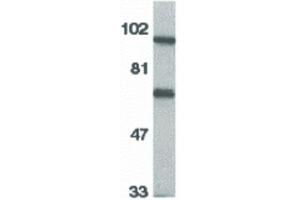 Image no. 2 for anti-Interleukin 1 Receptor Accessory Protein (IL1RAP) (C-Term) antibody (ABIN6655161)