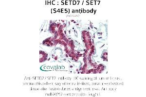Image no. 1 for anti-SET Domain Containing (Lysine Methyltransferase) 7 (SETD7) antibody (ABIN1723183)