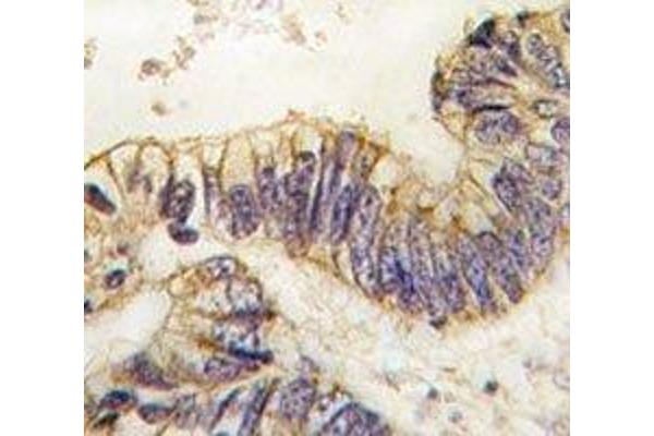 NCOA1 anticorps  (AA 1338-1367)