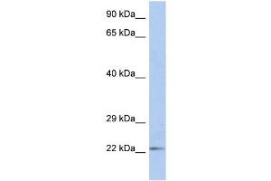 Image no. 2 for anti-Deoxyuridine Triphosphatase (DUT) (N-Term) antibody (ABIN630705)