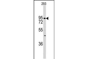 Image no. 1 for anti-K-Cadherin (CDH6) (AA 665-695), (C-Term) antibody (ABIN5534054)