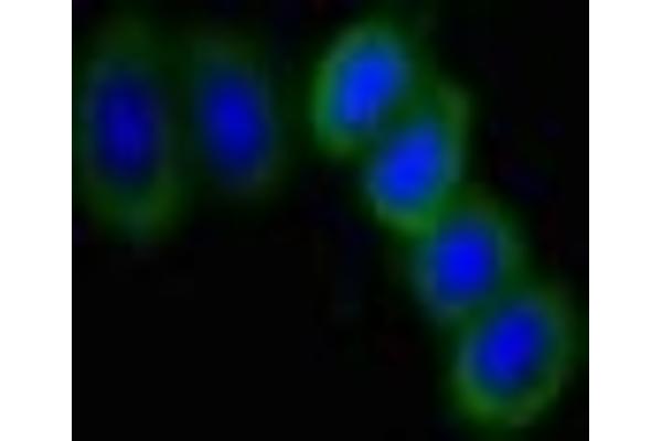 SLITRK6 Antikörper  (AA 621-821)