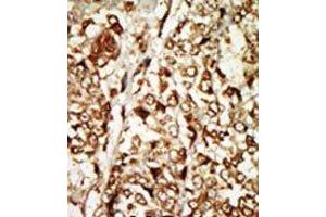 Image no. 2 for anti-Moloney Sarcoma Oncogene (MOS) (N-Term) antibody (ABIN360532)