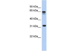 Image no. 2 for anti-Ribosomal Protein S3A (RPS3A) (N-Term) antibody (ABIN2786535)