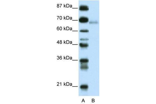 anti-Zinc Finger and BTB Domain Containing 22 (ZBTB22) (C-Term) antibody