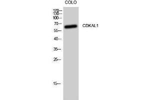 Image no. 1 for anti-CDK5 Regulatory Subunit Associated Protein 1-Like 1 (CDKAL1) (N-Term) antibody (ABIN3183845)