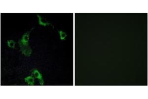 Image no. 1 for anti-Cell Death-Inducing DFFA-Like Effector B (CIDEB) (AA 91-140) antibody (ABIN1534431)