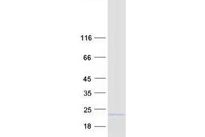 Image no. 1 for ASF1 Anti-Silencing Function 1 Homolog B (ASF1B) protein (Myc-DYKDDDDK Tag) (ABIN2714978)