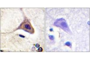 Immunohistochemistry analysis of paraffin-embedded human brain, using Opioid Receptor-delta (Phospho-Ser363) Antibody.