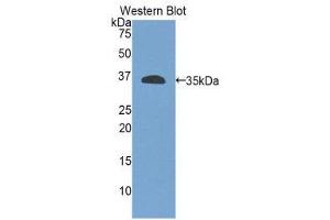 Image no. 1 for anti-Integrin beta 4 (ITGB4) (AA 923-1197) antibody (ABIN1859507)
