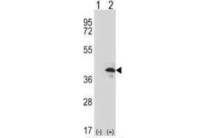 Image no. 3 for anti-ZW10 Interactor (ZWINT) (Middle Region) antibody (ABIN453487)