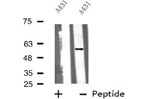Image no. 1 for anti-Cytochrome P450, Family 51, Subfamily A, Polypeptide 1 (CYP51A1) (Internal Region) antibody (ABIN6258371)