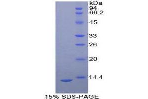 Image no. 1 for Plasminogen Activator, Urokinase Receptor (PLAUR) (AA 13-114) protein (His tag) (ABIN1080530)