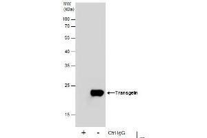 Image no. 4 for anti-Transgelin (TAGLN) (Center) antibody (ABIN2855103)