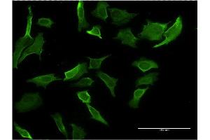 Immunofluorescence (IF) image for anti-Major Histocompatibility Complex, Class I-Related (MR1) (AA 201-300) antibody (ABIN516526)