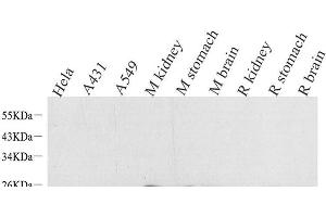 Western Blot analysis of various samples using NTS Polyclonal Antibody at dilution of 1:1000.