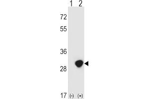 Image no. 2 for anti-Triosephosphate Isomerase 1 (TPI1) antibody (ABIN3001712)
