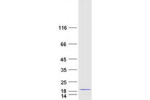 Image no. 1 for Mitochondrial Ribosomal Protein S6 (MRPS6) protein (Myc-DYKDDDDK Tag) (ABIN2726413)