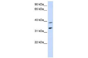 Image no. 1 for anti-Solute Carrier Family 25, Member 34 (SLC25A34) (Middle Region) antibody (ABIN635088)
