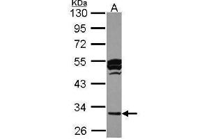 Image no. 2 for anti-Cathepsin O (CTSO) (Center) antibody (ABIN2856154)