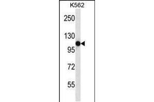 Image no. 1 for anti-Sema Domain, Immunoglobulin Domain (Ig), Transmembrane Domain (TM) and Short Cytoplasmic Domain, (Semaphorin) 4C (SEMA4C) (AA 792-821), (C-Term) antibody (ABIN5538490)
