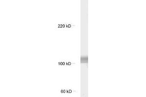 Image no. 2 for anti-F-Box Protein 41 (FBXO41) antibody (ABIN2690505)