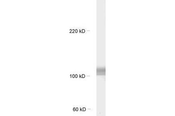 FBXO41 antibody