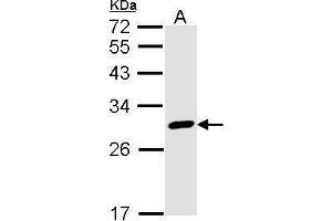 Image no. 3 for anti-Calbindin 2 (CALB2) (Center) antibody (ABIN2855596)
