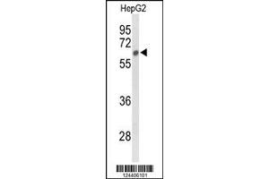Image no. 1 for anti-N-Sulfoglucosamine Sulfohydrolase (SGSH) (AA 420-449), (C-Term) antibody (ABIN653531)