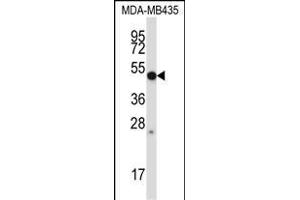 MMP28 Antikörper  (AA 195-223)