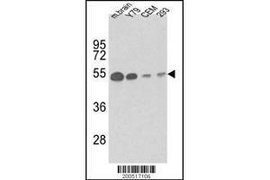 Image no. 2 for anti-Tubulin, beta 1 (TUBB1) antibody (ABIN658975)