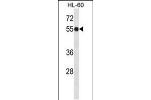 Image no. 1 for anti-Inosine 5'-Phosphate Dehydrogenase 1 (IMPDH1) (AA 84-113), (N-Term) antibody (ABIN5538393)