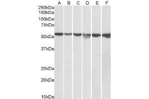 Image no. 2 for anti-Glucose-6-Phosphate Isomerase (GPI) (AA 81-93) antibody (ABIN571080)
