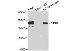 Image no. 3 for anti-Eukaryotic Translation Initiation Factor 4B (EIF4B) antibody (ABIN6569899)